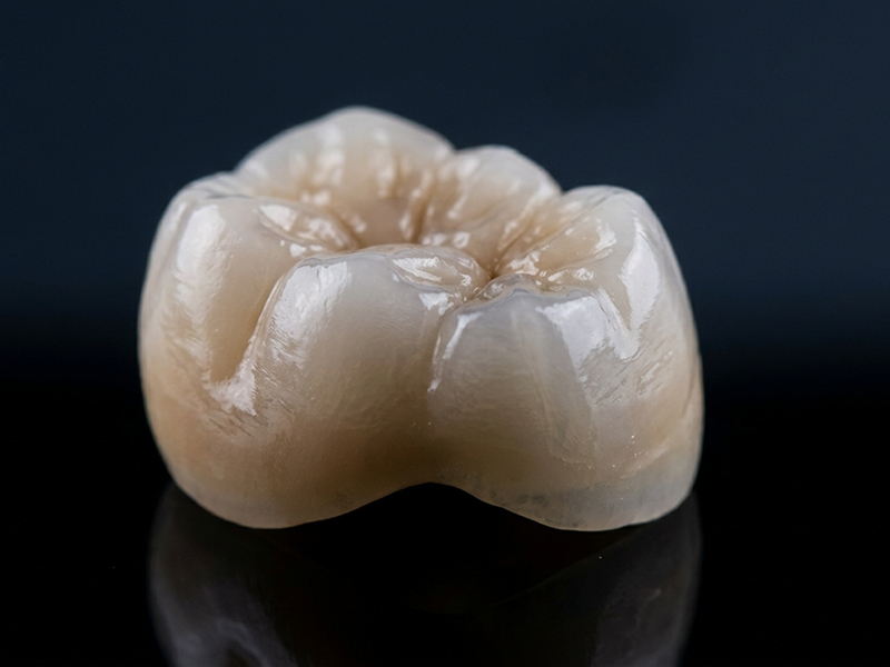 Esthetic Zirconia